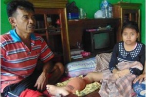 Pengidap tomor, Dewi bersama orang tuanya